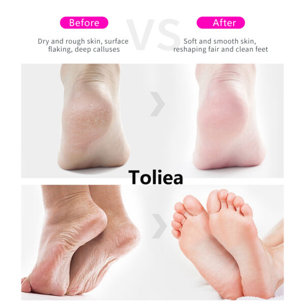 Toliea TL-A5 Electric Foot File, Adjustable Rotary Electric Foot Dead Cell Remover,Foot Care Tool Manicure Cutics Salon Nail Pink - Image 5